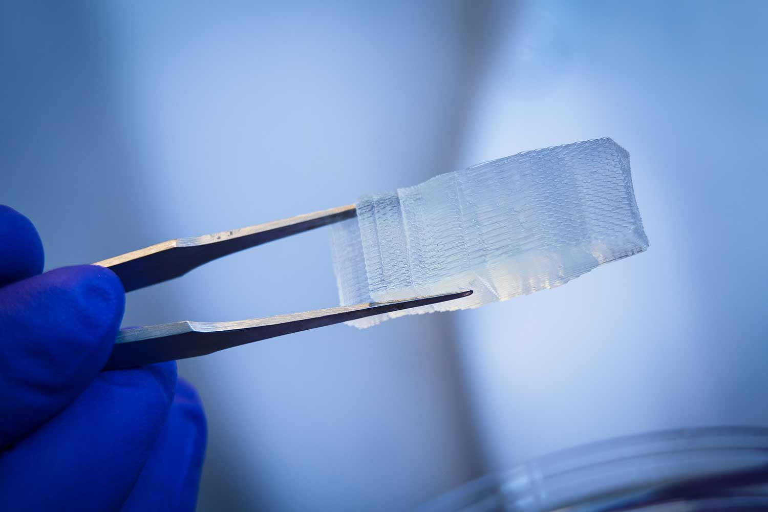 Advanced 3D printed surgical implants